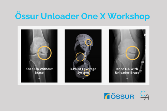 Össur Unloader One X Brace Workshop